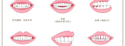 牙齿矫正的好处，重庆北培贝乐嘉口腔